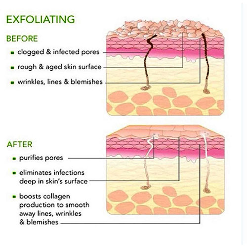 AHAs stimulate the exfoliation of old, roughened skin to promote cell renewal. This process speeds up the skin regeneration process.