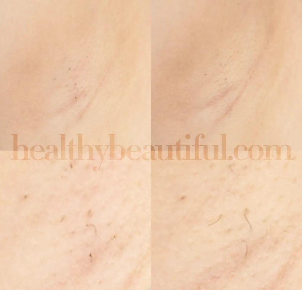 Image: Hair growth on underarms after a month using Power Mode. / Healthybeautiful.com
